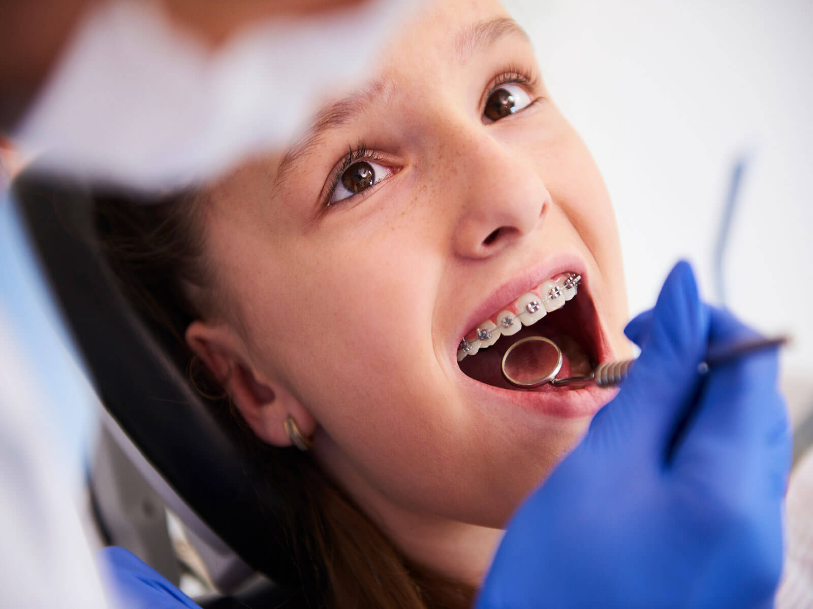 Top Reasons Your Child Might Need Braces