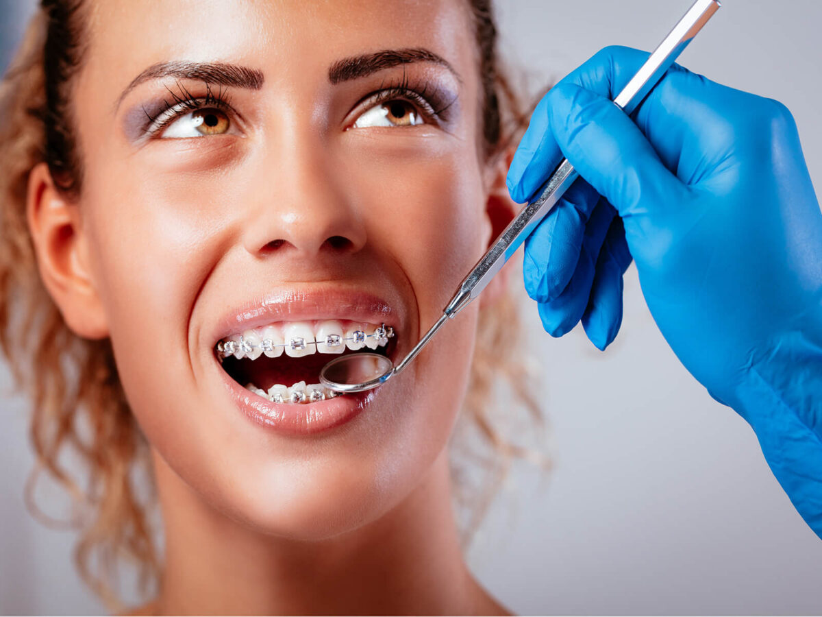 Teeth Whitening