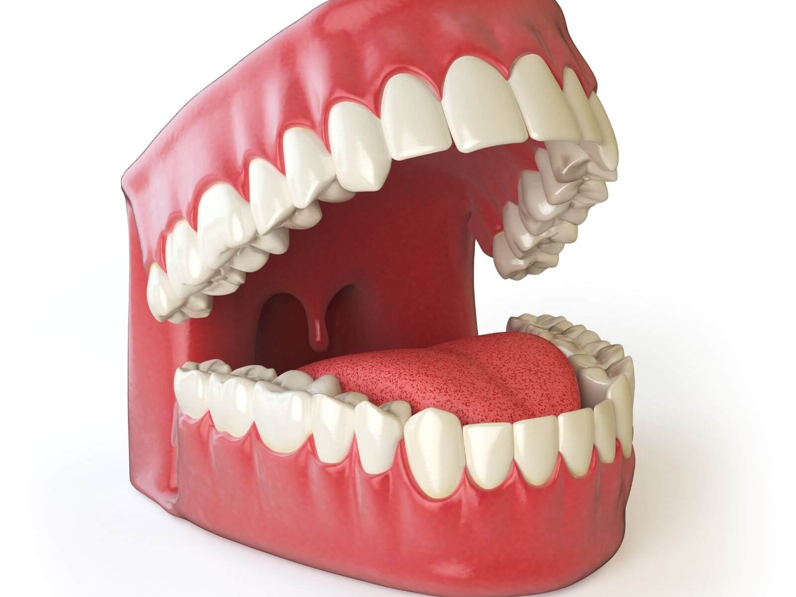 When To Replace Your Dentures: Signs It’s Time For A New Set
