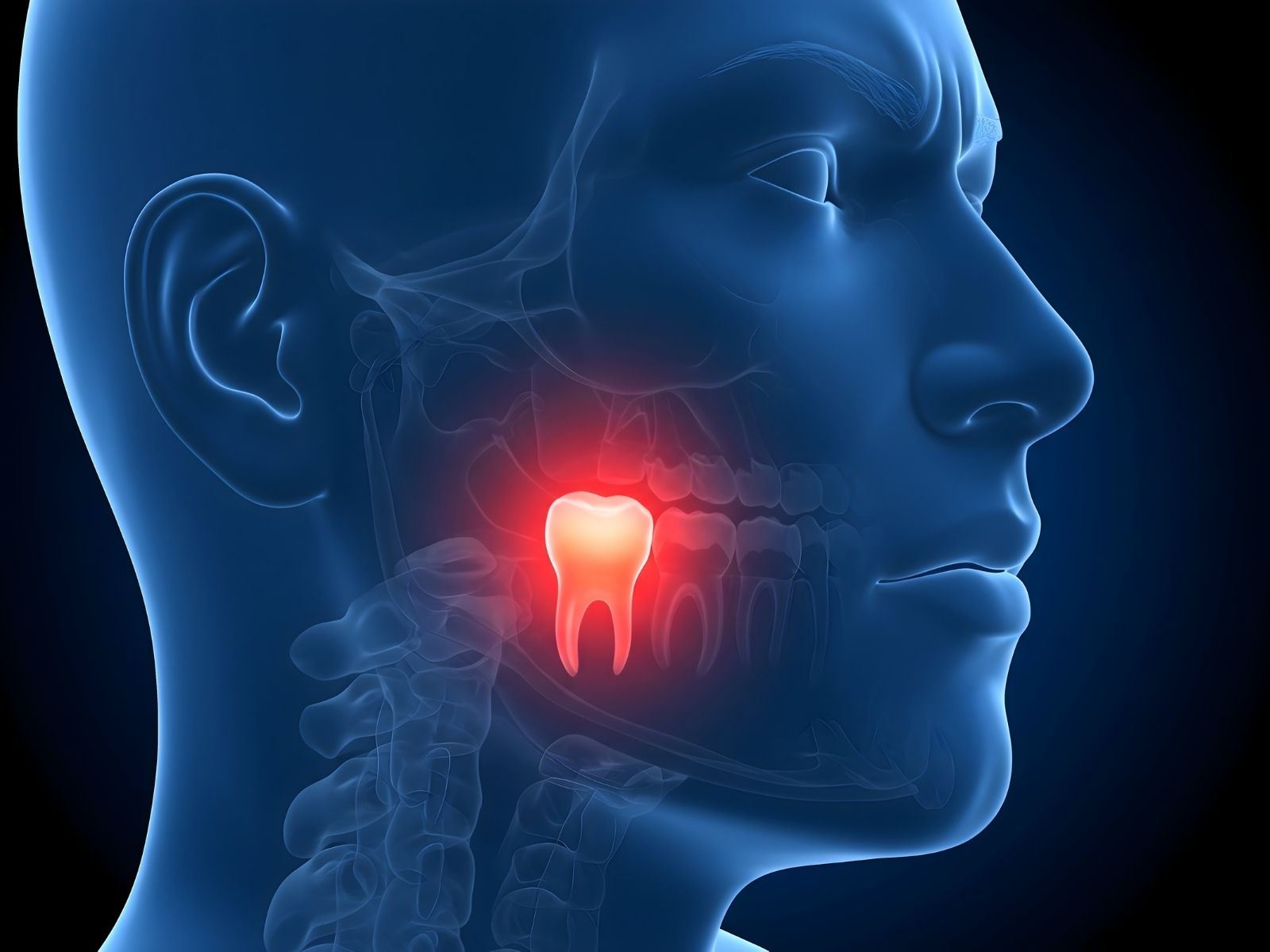 Wisdom Tooth Removal Recovery: A Day-by-Day Guide to Healing